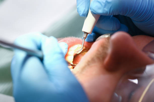 Best Knocked-Out Tooth Emergency  in Miamisburg, OH